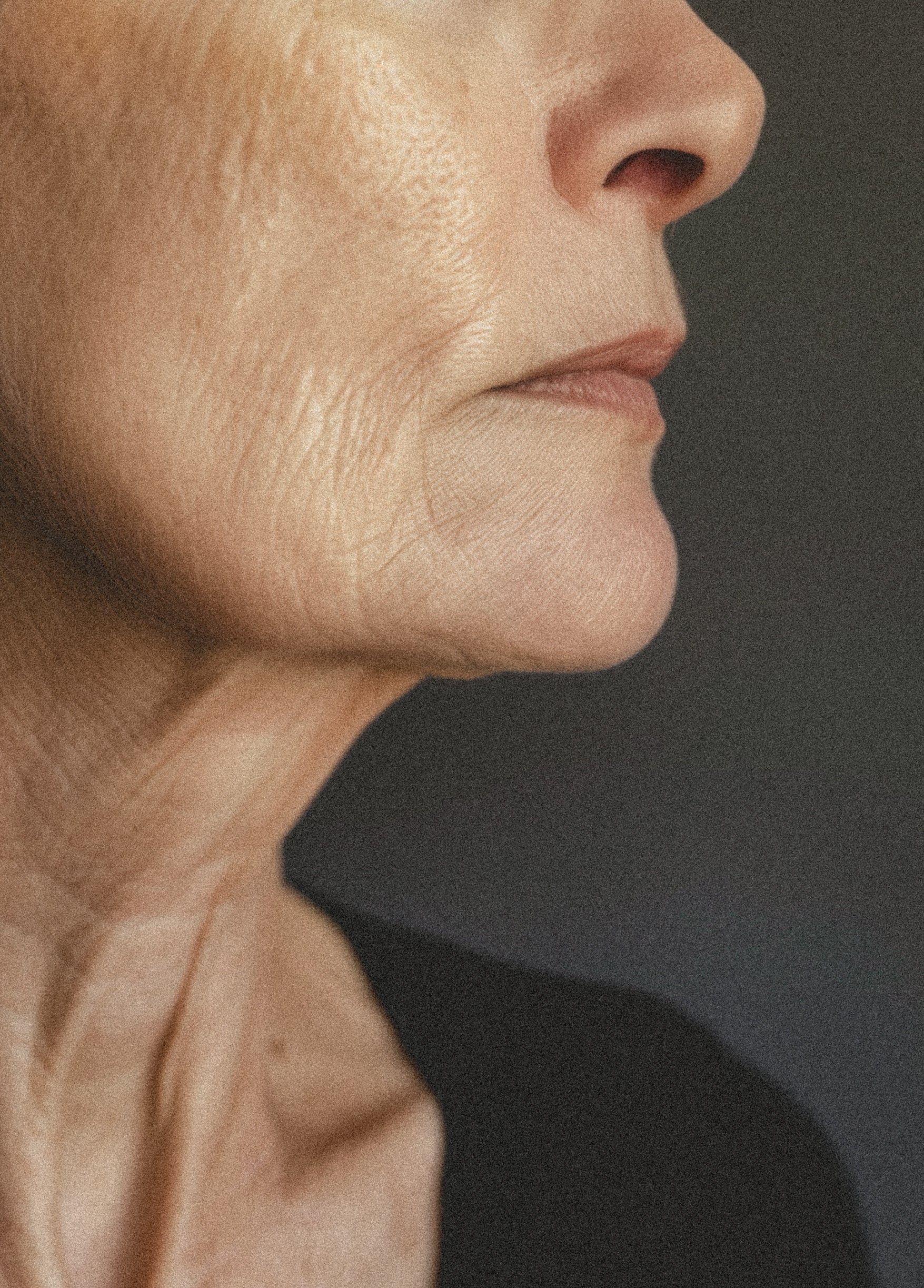 Aspect Dr Anti Ageing
