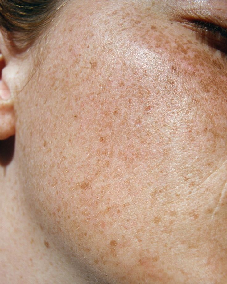 Aspect Dr Complete Pigment Plus Reviews