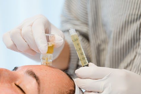 PRP and PRF facial injectable treatment. Clinic performs Rejuran treatments